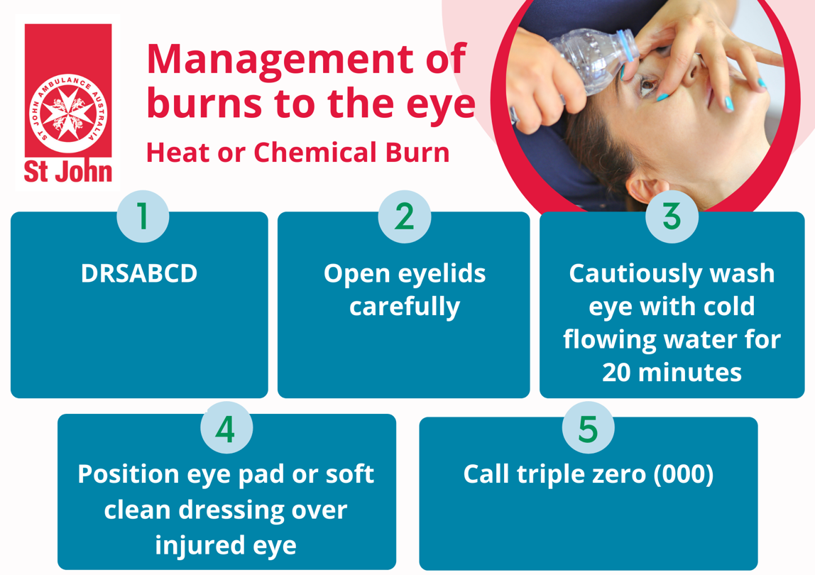 Eye Injury First Aid Tips St John Vic