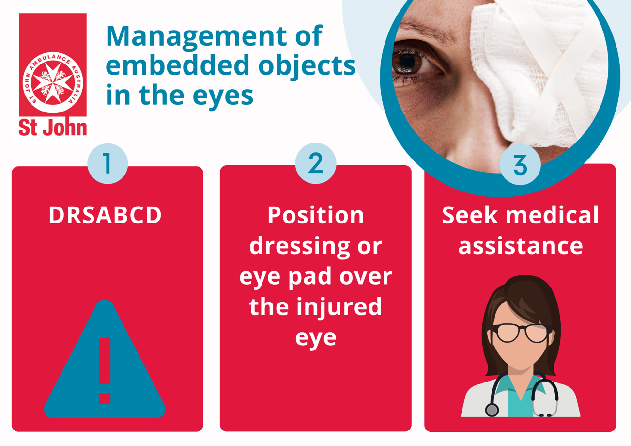 Eye Injury First Aid Tips St John Vic